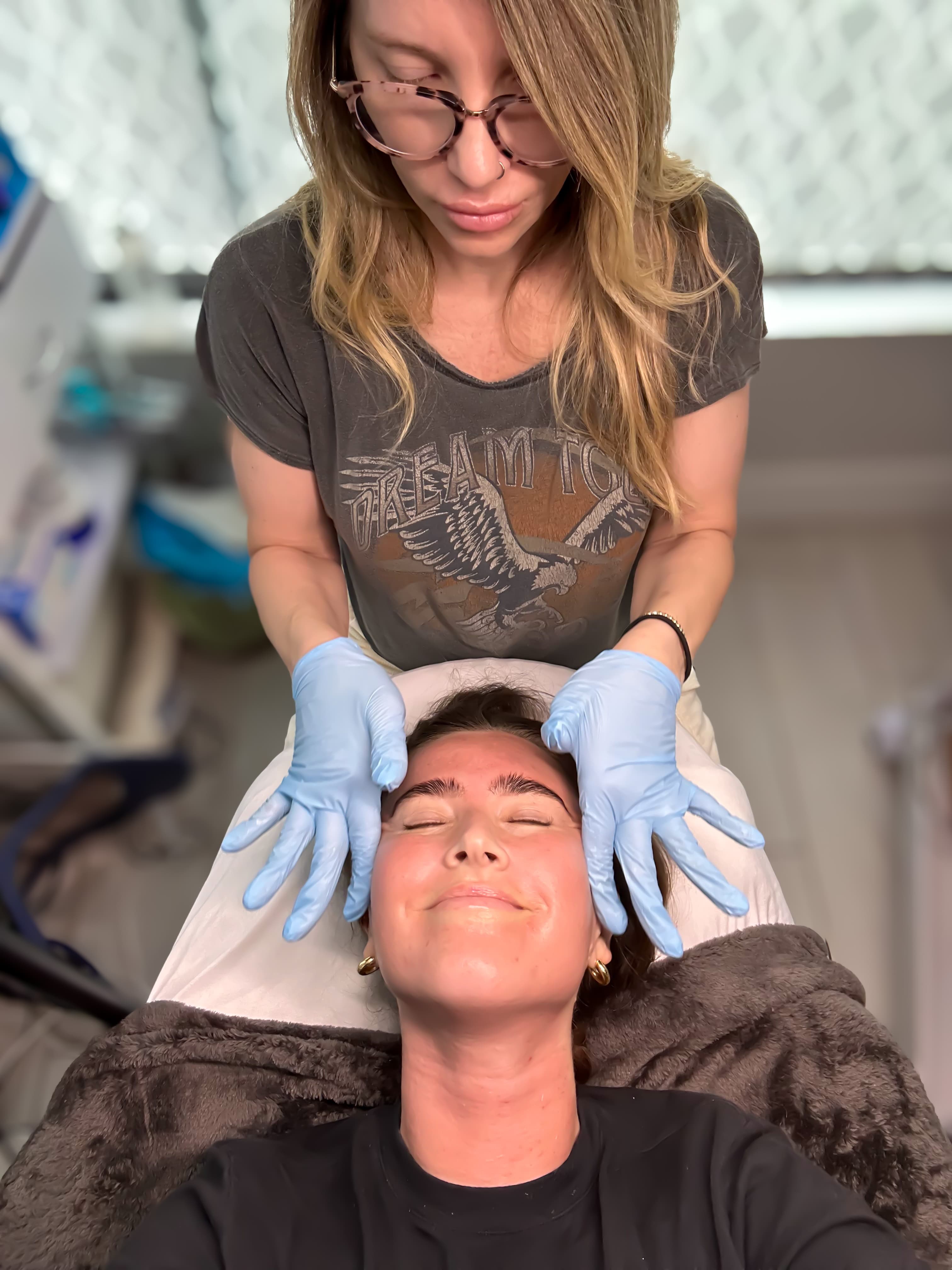 microneedling